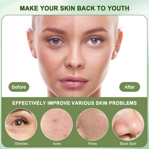 Özel etiket YEŞİL ÇAY yüz kil maskesi Anti-Aging nemlendirici temizleme bambu zerdeçal yüz maskesi kil çamur maskesi - Product Image 4