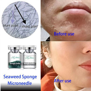 Set <span class=keywords><strong>de</strong></span> Exfoliación con <span class=keywords><strong>Algas</strong></span> Orgánicas, Biomicroneedling, Espículas <span class=keywords><strong>de</strong></span> Esponja, Polvo Exfoliante Facial Natural, Blanqueador, Antiarrugas, para el Tratamiento del Acné - Product Image 2
