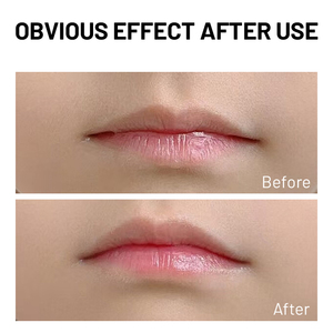 Bálsamo Labial para Bebés a Base de Plantas de Marca Privada, Anti Resequedad, Alivia el Enrojecimiento y la Picazón, Protege, Nutre y Calma - Product Image 4