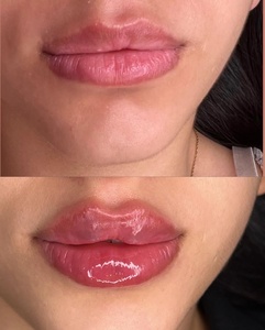 Magic Pout, Relleno Labial Suave Instantáneo y Natural en Jeringa, Brillo Labial Voluminizador, Logotipo Personalizado - Product Image 6