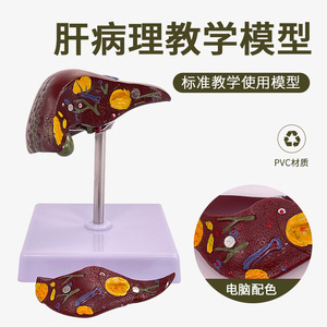 Modèle de pathologie hépatique, modèle de foie gras, modèle hépatobiliaire, foie malade, modèle d'anatomie hépatique humaine simulée - Product Image 1