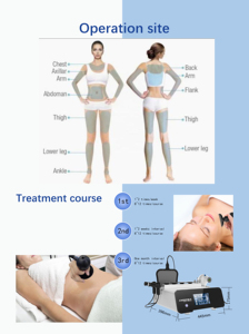 Vet Human <strong>Physiotherapy</strong> 20khz Deep Beauty Body Cellulite Fat Slimming Wrinkle Removal Skincare 448KHZ Tecar Therapy Machine - Product Image 5