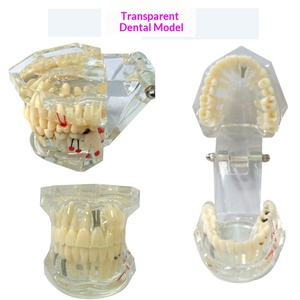 Modèle d'enseignement dentaire anatomique en résine pour implant dentaire, préparation au brossage des prothèses - Product Image 4