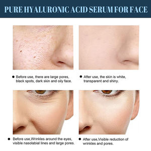 <span class=keywords><strong>Fil</strong></span> <span class=keywords><strong>de</strong></span> protéine <span class=keywords><strong>de</strong></span> <span class=keywords><strong>soie</strong></span> soluble dans l'eau, <span class=keywords><strong>fil</strong></span> <span class=keywords><strong>de</strong></span> <span class=keywords><strong>collagène</strong></span> pour lifting du visage, ligne <span class=keywords><strong>de</strong></span> peptide <span class=keywords><strong>de</strong></span> protéine d'or, vente en gros - Product Image 3