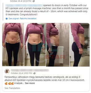 6D Lipo Laser therapie Gewichts verlust Fett verbrennung Lipolyse Schönheits salon Ausrüstung Fett absaugung Hauts kulptor Hauts traffung - Product Image 4