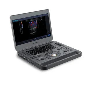 4d taşınabilir ultrason makinesi sonoscape x5 kardiyo