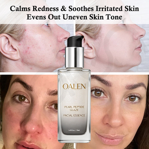 Oalen Private Label 3 en 1 Essence Tonique Sérum Anti-Âge Collagène Peptides Poudre de Perle Hydratant Repulpant Préparation Visage - Product Image 2