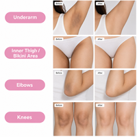 Krim Pemutih Kulit untuk Ketiak Gelap, Lutut, Siku, Paha Bagian Dalam, Garis Bikini, Krim Pemutih Area Ketiak