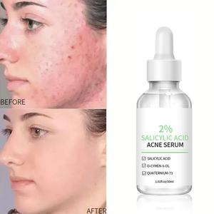 Suero Facial para el Cuidado de la Piel de 30 ml, Elimina el Acné Profundo, Aclara la Piel, con 2% de Ácido Salicílico - Product Image 6