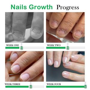 Waterproof Bitter <strong>Nail</strong> <strong>Polish</strong> Anti Bite <strong>Stop</strong> <strong>Nail</strong> <strong>Biting</strong> Thumb Sucking Preventer for Kids - Product Image 4