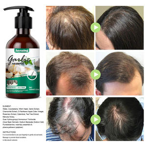 Champú de ajo de etiqueta privada, champú anticaspa para el cabello, champú para el crecimiento anticaída, champú nutritivo para el cabello - Product Image 4