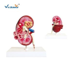 Medisch Wetenschappelijk Product Pathologisch Anatomiemodel Van Niercyste Nierziekte Model Menselijk Anatomiemodel - Product Image 2