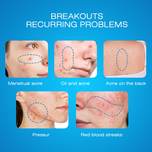 Sumifun eliminación removedor de manchas oscuras Ance crema fuerte blanqueamiento cara pecas eliminar crema correctora - Product Image 6