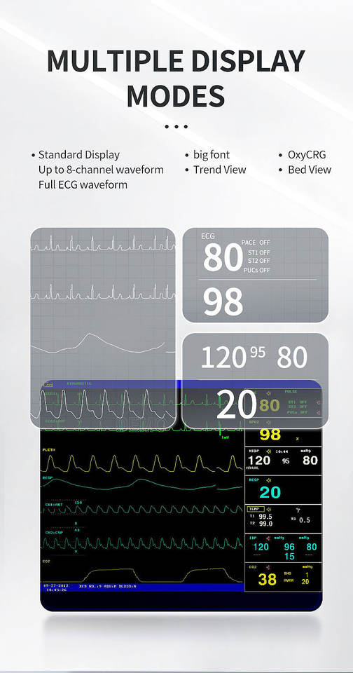 CONTEC CMS8000-1 Patient Monitor Vital Signs Monitor for Hospital ...