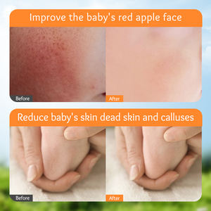 Private Label SADOER <span class=keywords><strong>Calendula</strong></span> per bambini vitamina E <span class=keywords><strong>crema</strong></span> idratante idratante E idratante <span class=keywords><strong>crema</strong></span> <span class=keywords><strong>lenitiva</strong></span> Anti-acari delicata - Product Image 5