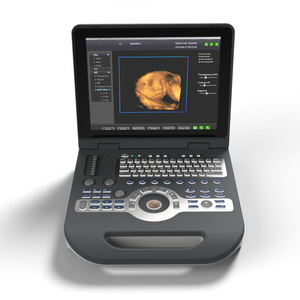 Escáner de Ultrasonido LTUB65, Máquina de Ultrasonido Doppler a Color 4D con <span class=keywords><strong>Precio</strong></span> Razonable, Sistema de Diagnóstico por Ultrasonido - Product Image 5