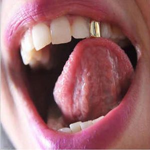 Grillz Placcato Oro 18K Hip Hop, Copertura Singola per Dente Superiore, per Uomini e <span class=keywords><strong>Donne</strong></span>, Accessori per Cosplay e Rapper - Product Image 2