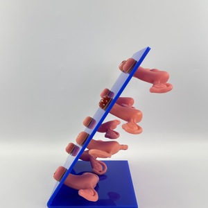 Matériel pédagogique de simulation gynécologique : Modèle de lésion utérine médicale ; 8 modèles anatomiques de malformations utérines. - Product Image 2
