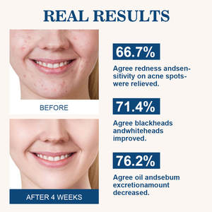 Soro Natural Orgânico Do Rosto Do OEM Soro De Clareamento Reparo De Pele Antioxidante Hidratante Nutritivo Soro De Rosto - Product Image 2