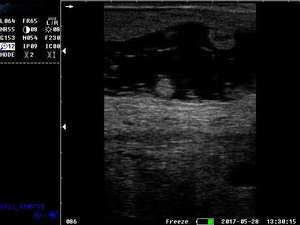 बी/डब्ल्यू गर्भावस्था निदान के लिए अल्ट्रासाउंड रैखिक जांच पशु अल्ट्रासाउंड नैदानिक प्रणाली - Product Image 5