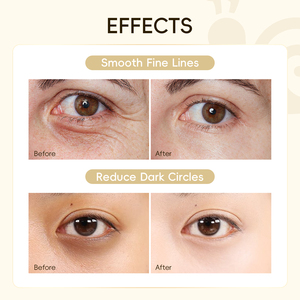 LAIKOU 50 ชิ้น โกลด์ สเนล อาย มาส์ก 70 กรัม เจลลดริ้วรอยสำหรับผิวแพ้ง่าย ลดรอยคล้ำใต้ตา บำรุงและฟื้นฟูผิวรอบดวงตา - Product Image 2