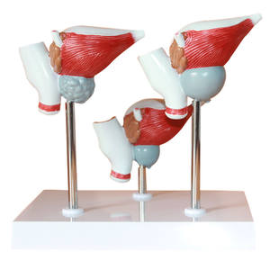 Nuevo Modelo Anatómico Patológico de Próstata para Enseñanza Médica, Sistema Reproductivo Masculino, Urología, Material Didáctico de Planificación Familiar - Product Image 3