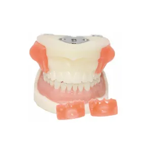 Dental Bilateral Maxillary Cyst Doctors Qualification Examination Teeth Model
