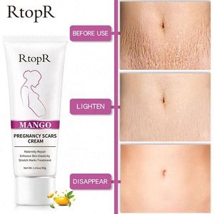 RtopR品牌芒果乳液有效治疗妊娠纹和妊娠疤痕身体皮肤护理霜 - Product Image 3