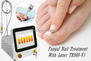 <span class=keywords><strong>Tratamiento</strong></span> para eliminación efectiva de <span class=keywords><strong>hongos</strong></span> en las <span class=keywords><strong>uñas</strong></span>, Láser de Diodo de 60w, para las <span class=keywords><strong>uñas</strong></span> de los pies, onicomicosis, Clase IV, 980nm - Product Image 3