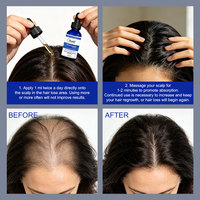 Sérum Anti-Chute en Gros 60ml avec 2% Kopyrrol, Gingembre, Centella et Biotine Zinc PCA pour la Réparation des Cheveux Abîmés et la Densité Capillaire