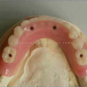 Ponte dentario contemporaneo dell'impianto ad arco pieno dentale a ponte di <span class=keywords><strong>Zirconia</strong></span> con qualità ottimale - Product Image 3