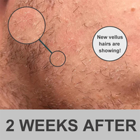 Sérum Capillaire et Barbe Efficace pour la Prévention de la Chute de Cheveux et la Croissance chez l'Homme