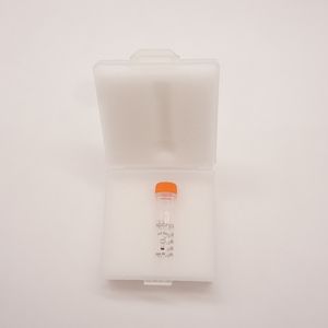 Sonde double couleur TP53/CSP17 pour le cancer de la vessie, le cancer de la prostate, la leucémie lymphoïde chronique - Product Image 4