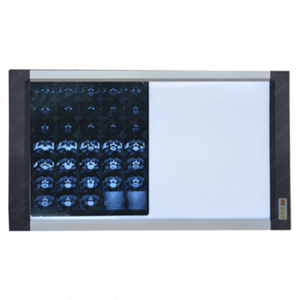 NH01 Nhà Máy Giá X-Ray <span class=keywords><strong>viewbox</strong></span> độ sáng cao LED X-Ray phim <span class=keywords><strong>viewbox</strong></span> Màn hình duy nhất để bán - Product Image 6