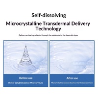 Patch nasal microcristallin en gros d'usine, patch nasal hydrocolloïde microcristallin soluble à l'acide hyaluronique avec micro-aiguilles pour les yeux
