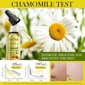 Productos para el Cuidado de la Piel SADOER, Aceite Esencial de Plantas, <span class=keywords><strong>Romero</strong></span>, Rosa, Lavanda, Manzanilla, Flor Seca, Aceite de Masaje Nutritivo Multiefectos - Product Image 4