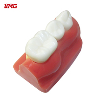 Dentiste dentaire Modèle de Dents De Démonstration D'implant L'analyse Couronne Pont bon