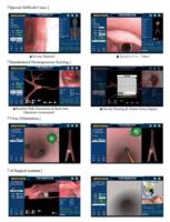 Sistema de Entrenamiento Virtual de Vías Respiratorias Compacto para Broncoscopia con Datos Anatómicos Chinos, Cajas Clínicas Completas para Todas las Edades