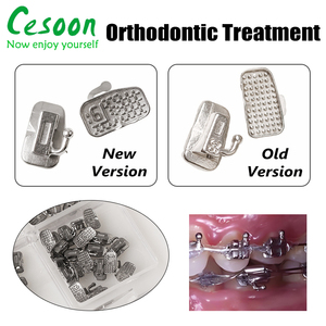 Tube buccal orthodontique <span class=keywords><strong>dentaire</strong></span> <span class=keywords><strong>pour</strong></span> 1ère <span class=keywords><strong>molaire</strong></span>, monobloc adhésible, non convertible, Roth MBT 0.022, hygiène buccale - Product Image 5