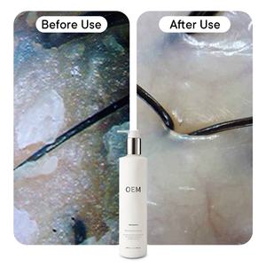 Champú para <span class=keywords><strong>el</strong></span> cabello con grasa de 300Ml para <span class=keywords><strong>cuero</strong></span> <span class=keywords><strong>cabelludo</strong></span> graso Etiqueta privada Champú purificante de 300Ml para reducir <span class=keywords><strong>el</strong></span> exceso de aceite <span class=keywords><strong>en</strong></span> <span class=keywords><strong>el</strong></span> <span class=keywords><strong>cuero</strong></span> <span class=keywords><strong>cabelludo</strong></span> - Product Image 2