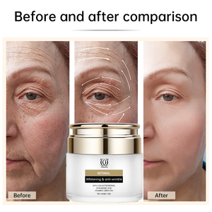 Crème éclaircissante anti-rides Calantha au rétinol 2,5% rétinol actif, éclaircit la peau, lisse <span class=keywords><strong>les</strong></span> rides, hydratation intense, crème à la vitamine HA - Product Image 6