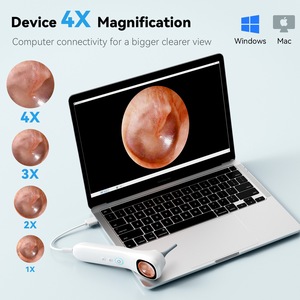 กล้องดิจิตอล4อิน1 1080P HD ช่องจมูก<span class=keywords><strong>ผิว</strong></span>หนังบริเวณปากเครื่องตรวจจับช่องหูแบบชาร์จไฟได้1000mAh - Product Image 6