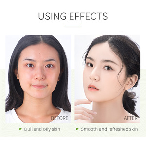 Mascarilla de Barro Matcha LAIKOU, Arcilla Verde para el Tratamiento del Acné y las Espinillas, Control de Grasa, Reduce los Poros, Blanquea, Hidrata, Cuidado de la <span class=keywords><strong>Piel</strong></span> - Product Image 5
