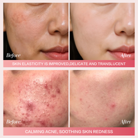 Sérum Visage 4-en-1 OEM Hydratant Anti-Âge Réparateur Éclaircissant à la Nicotinamide et Vitamines C & E
