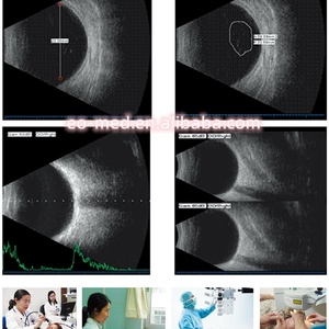 Dispositivos de Diagnóstico Ultrasónico Portátiles de Alta Eficiencia, Escáner Oftálmico de Ultrasonido A/B con Precio Bajo EUS500 - Product Image 6