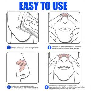 อุปกรณ์ช่วยหายใจขณะนอนหลับแบบขยายรูจมูก ป้องกันการกรน ยี่ห้อ OEM รับผลิตแบบ Private Label พร้อมโลโก้และขนาดที่กำหนดเองได้ - Product Image 4