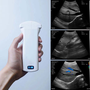Tragbares Ultraschall gerät für Sport verletzungen mit MSK-optimierter Sonde mit Ultraschall-auf-Chip-Technologie - Product Image 6