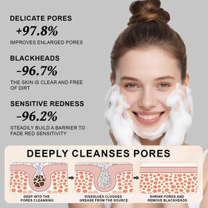 Produits de soin de la peau pour minimiser les pores et nettoyer en profondeur, nettoyant visage à l'eau de riz, vitamine C, nettoyant visage anti-acné - Product Image 6