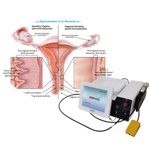 2024 Máquina de ajuste vaginal Fisioterapia ginecológica Rejuvenecimiento vaginal láser 980nm 1470nm Diodo láser dolor vaginal - Product Image 1