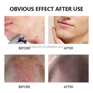 プライベートブランドのアフターシェーブクリーム、かみそり負けを防ぎ、かみそり負け後の炎症や埋没毛を軽減するアフターシェーブバーム - Product Image 5